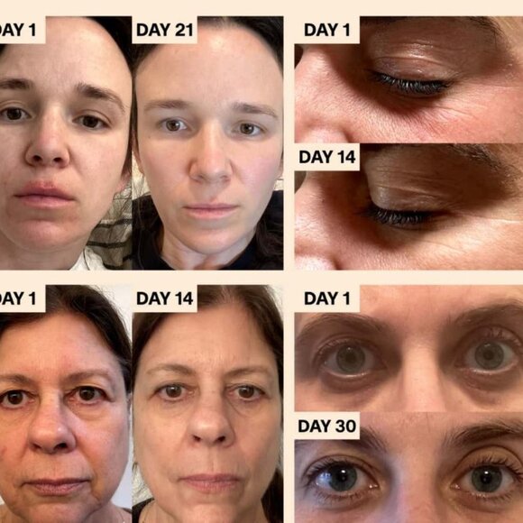 4-in-1 Radiant Renewal Red and Blue Light Skincare Wand Therapy (Rose Gold) New - Picture 8 of 14